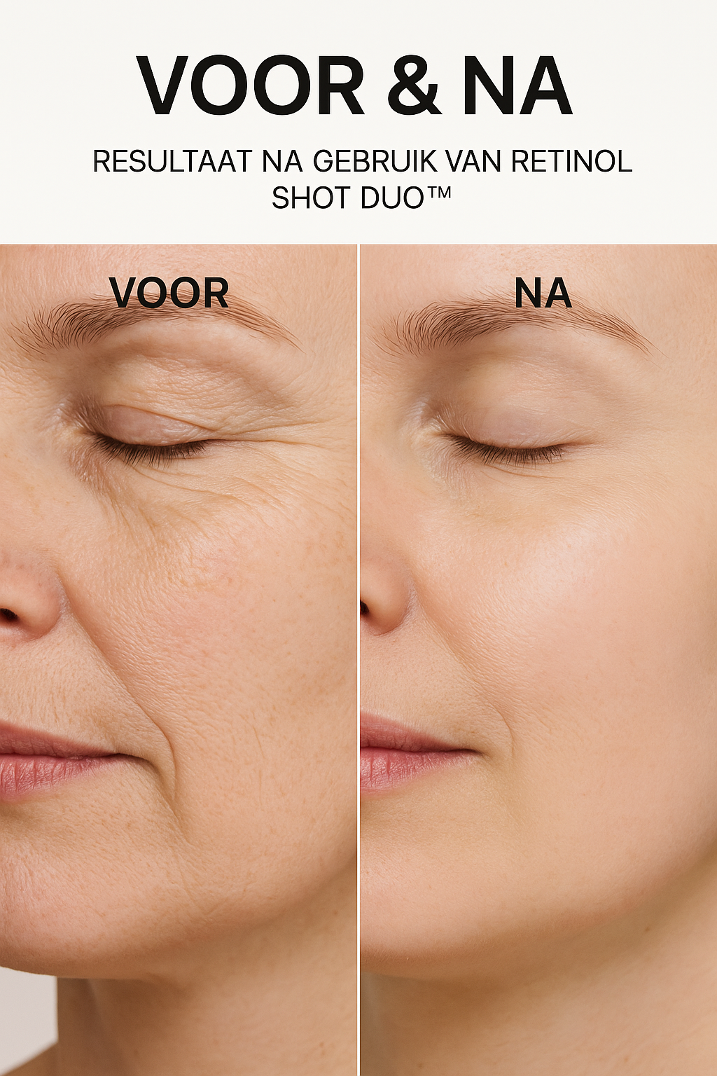 Vita-A Retinol Shot Serum